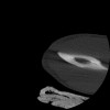 SPORK, NICO - 22.03.1976 - 02.08.2022 - CT obere Extremität - 17:51:17